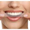 Ultra White Benzi albirea dintilor efect 3D 3